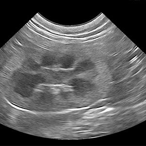 ultrasound of a cat kidney