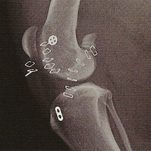 digital x-ray of knee repair